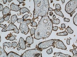 CD39/ENTPD1 Rabbit anti-Human, Mouse, Rat, Polyclonal, Proteintech 150