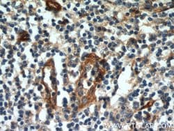 CD39/ENTPD1 Rabbit anti-Human, Mouse, Rat, Polyclonal, Proteintech 150