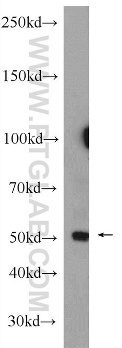 CD39/ENTPD1 Rabbit anti-Human, Mouse, Rat, Polyclonal, Proteintech 150