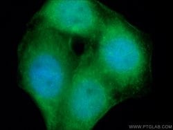 NF-kB Rabbit anti-Human, Rat, Polyclonal, Proteintech 150 &mu;L; Unconjugated:Antibodies,
