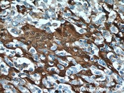 S100A9 Rabbit anti-Human, Mouse, Rat, Polyclonal, Proteintech 150 &mu;L;