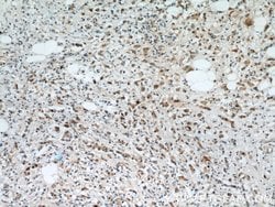 S100A9 Rabbit anti-Human, Mouse, Rat, Polyclonal, Proteintech 150 &mu;L;