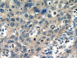 RAP1GAP Rabbit anti-Human, Mouse, Rat, Polyclonal, Proteintech 20 &mu;L | Buy Online | Proteintech | Fisher Scientific