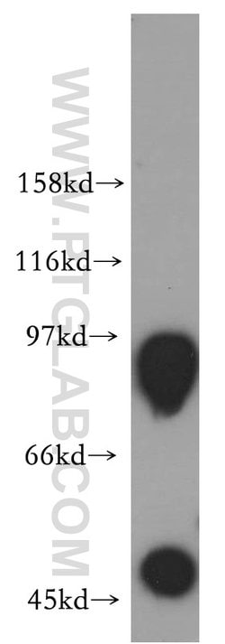 RAP1GAP Rabbit anti-Human, Mouse, Rat, Polyclonal, Proteintech 20 &mu;L | Buy Online | Proteintech | Fisher Scientific