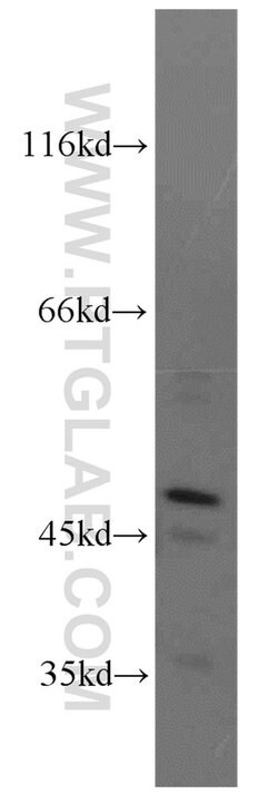 NEK2 Rabbit anti-Human, Mouse, Rat, Polyclonal, Proteintech:Antibodies:Primary