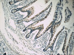 Autotaxin Rabbit anti-Human, Mouse, Rat, Polyclonal, Proteintech:Antibodies:Primary