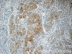 Autotaxin Rabbit anti-Human, Mouse, Rat, Polyclonal, Proteintech:Antibodies:Primary