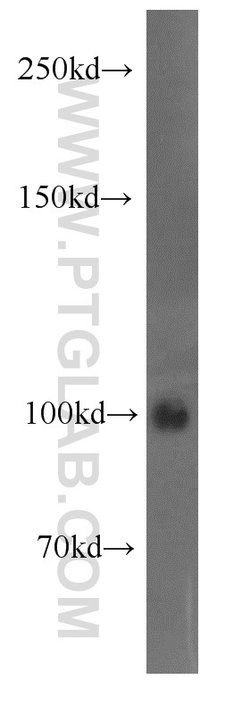 Autotaxin Rabbit anti-Human, Mouse, Rat, Polyclonal, Proteintech:Antibodies:Primary