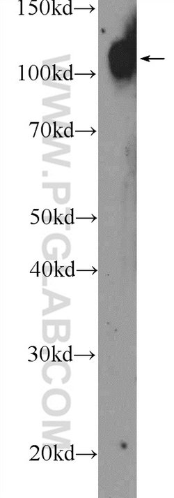 Autotaxin Rabbit anti-Human, Mouse, Rat, Polyclonal, Proteintech:Antibodies:Primary