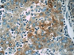 Autotaxin Rabbit anti-Human, Mouse, Rat, Polyclonal, Proteintech:Antibodies:Primary
