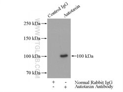 Autotaxin Rabbit anti-Human, Mouse, Rat, Polyclonal, Proteintech:Antibodies:Primary