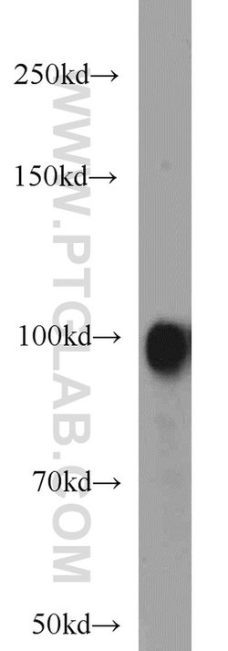 Autotaxin Rabbit anti-Human, Mouse, Rat, Polyclonal, Proteintech:Antibodies:Primary