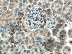 MYL5 Rabbit anti-Human, Mouse, Polyclonal, Proteintech:Antibodies:Primary