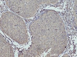 MYL5 Rabbit anti-Human, Mouse, Polyclonal, Proteintech:Antibodies:Primary