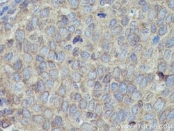 MYL5 Rabbit anti-Human, Mouse, Polyclonal, Proteintech:Antibodies:Primary