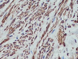 MYL5 Rabbit anti-Human, Mouse, Polyclonal, Proteintech:Antibodies:Primary