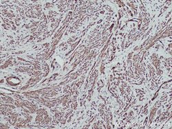 MYL5 Rabbit anti-Human, Mouse, Polyclonal, Proteintech:Antibodies:Primary