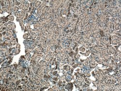 MYL5 Rabbit anti-Human, Mouse, Polyclonal, Proteintech:Antibodies:Primary