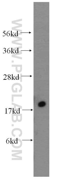 MYL5 Rabbit anti-Human, Mouse, Polyclonal, Proteintech:Antibodies:Primary