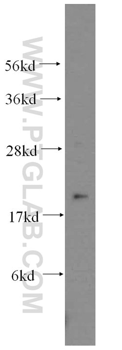 MYL5 Rabbit anti-Human, Mouse, Polyclonal, Proteintech:Antibodies:Primary