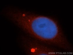 UBL4A Rabbit anti-Human, Mouse, Rat, Polyclonal, Proteintech 150 &mu;L;
