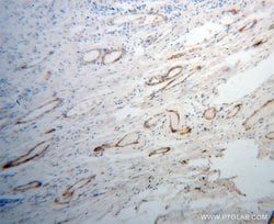 UBL4A Rabbit anti-Human, Mouse, Rat, Polyclonal, Proteintech 150 &mu;L;