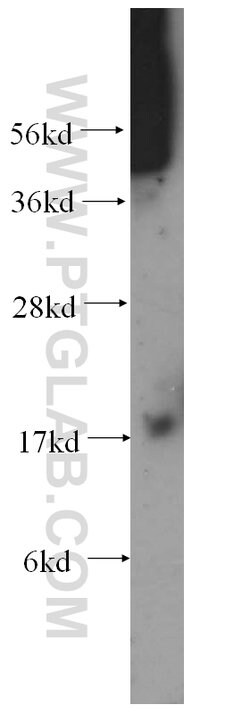 MTP18 Rabbit anti-Human, Mouse, Rat, Polyclonal, Proteintech:Antibodies:Primary