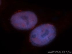 MBD3 Rabbit anti-Human, Mouse, Rat, Polyclonal, Proteintech:Antibodies:Primary