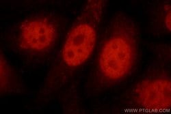 MBD3 Rabbit anti-Human, Mouse, Rat, Polyclonal, Proteintech:Antibodies:Primary