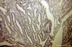 MBD3 Rabbit anti-Human, Mouse, Rat, Polyclonal, Proteintech:Antibodies:Primary