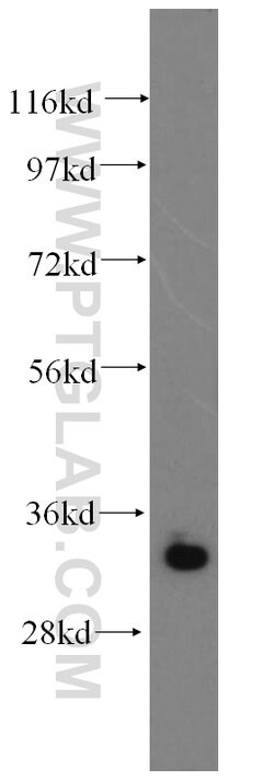 MBD3 Rabbit anti-Human, Mouse, Rat, Polyclonal, Proteintech:Antibodies:Primary