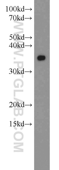 MBD3 Rabbit anti-Human, Mouse, Rat, Polyclonal, Proteintech:Antibodies:Primary