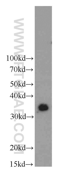 MBD3 Rabbit anti-Human, Mouse, Rat, Polyclonal, Proteintech:Antibodies:Primary