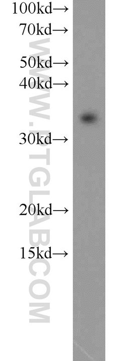 MBD3 Rabbit anti-Human, Mouse, Rat, Polyclonal, Proteintech:Antibodies:Primary
