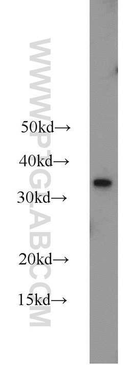 MBD3 Rabbit anti-Human, Mouse, Rat, Polyclonal, Proteintech:Antibodies:Primary