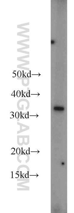 MBD3 Rabbit anti-Human, Mouse, Rat, Polyclonal, Proteintech:Antibodies:Primary