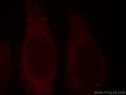 PNPLA6 Rabbit anti-Human, Mouse, Rat, Polyclonal, Proteintech:Antibodies:Primary