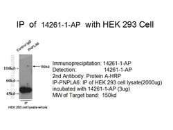 PNPLA6 Rabbit anti-Human, Mouse, Rat, Polyclonal, Proteintech:Antibodies:Primary