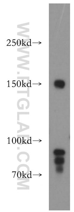 PNPLA6 Rabbit anti-Human, Mouse, Rat, Polyclonal, Proteintech:Antibodies:Primary
