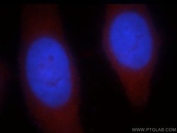 PNPLA6 Rabbit anti-Human, Mouse, Rat, Polyclonal, Proteintech:Antibodies:Primary