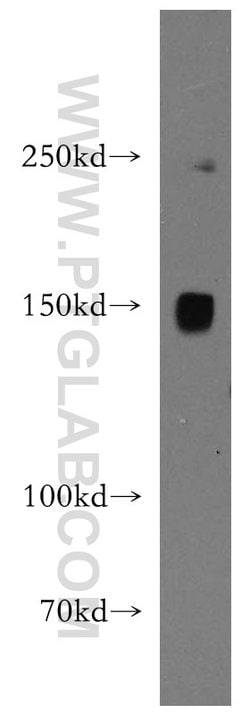 PNPLA6 Rabbit anti-Human, Mouse, Rat, Polyclonal, Proteintech:Antibodies:Primary