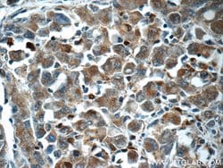 ITPKC Rabbit anti-Human, Polyclonal, Proteintech:Antibodies:Primary Antibodies