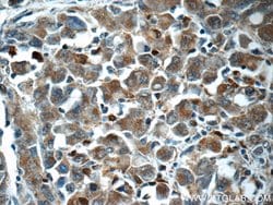 ITPKC Rabbit anti-Human, Polyclonal, Proteintech 150 &mu;L; Unconjugated:Antibodies,