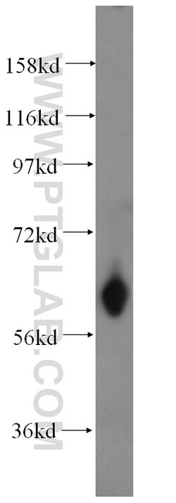 ABCG4 Rabbit anti-Human, Mouse, Rat, Polyclonal, Proteintech 20 &mu;L | Buy Online | Proteintech | Fisher Scientific