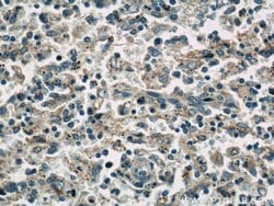 CNOT1 Rabbit anti-Human, Mouse, Rat, Polyclonal, Proteintech:Antibodies:Primary
