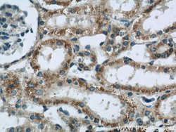 CNOT1 Rabbit anti-Human, Mouse, Rat, Polyclonal, Proteintech:Antibodies:Primary