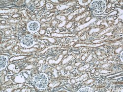 CNOT1 Rabbit anti-Human, Mouse, Rat, Polyclonal, Proteintech:Antibodies:Primary