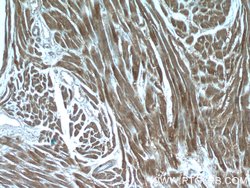 CNOT1 Rabbit anti-Human, Mouse, Rat, Polyclonal, Proteintech:Antibodies:Primary