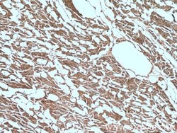 CNOT1 Rabbit anti-Human, Mouse, Rat, Polyclonal, Proteintech:Antibodies:Primary