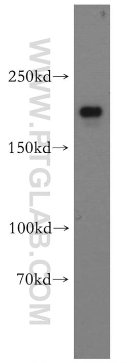 CNOT1 Rabbit anti-Human, Mouse, Rat, Polyclonal, Proteintech:Antibodies:Primary